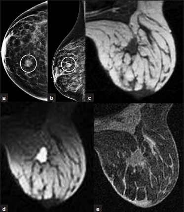Breast pathology scan